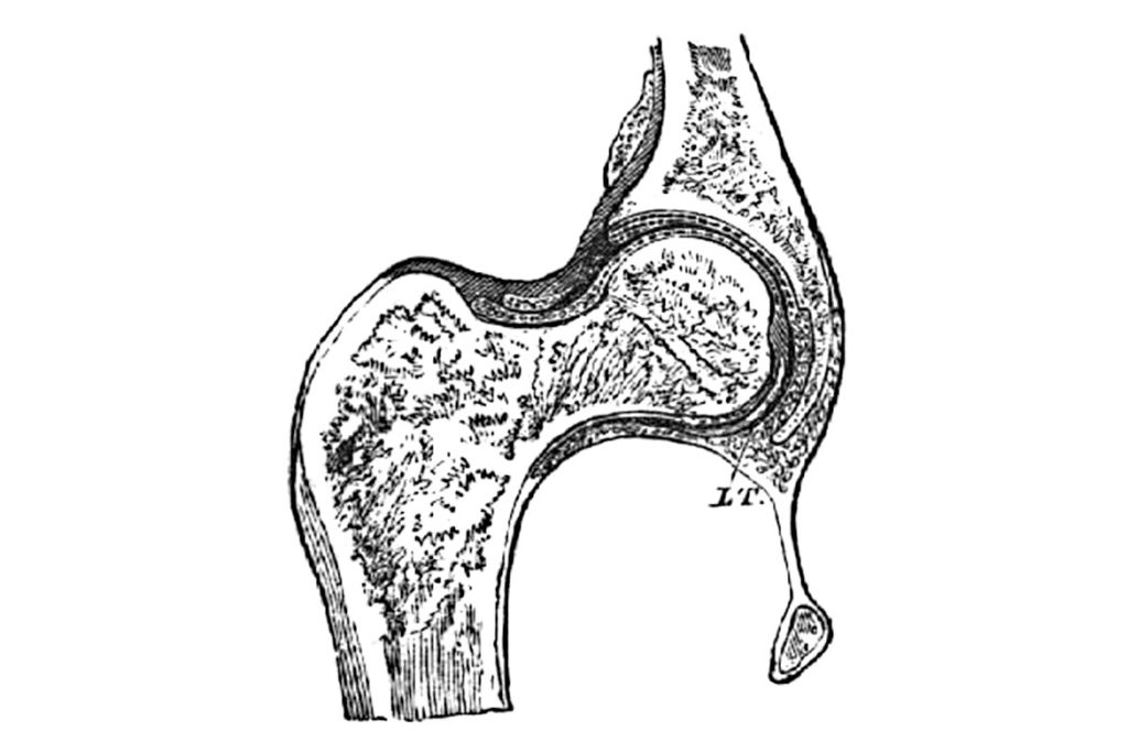 Articulación esférica anatómica con cabeza articular esférica y cavidad articular. Modelo para articulaciones móviles en la construcción de máquinas y vehículos.